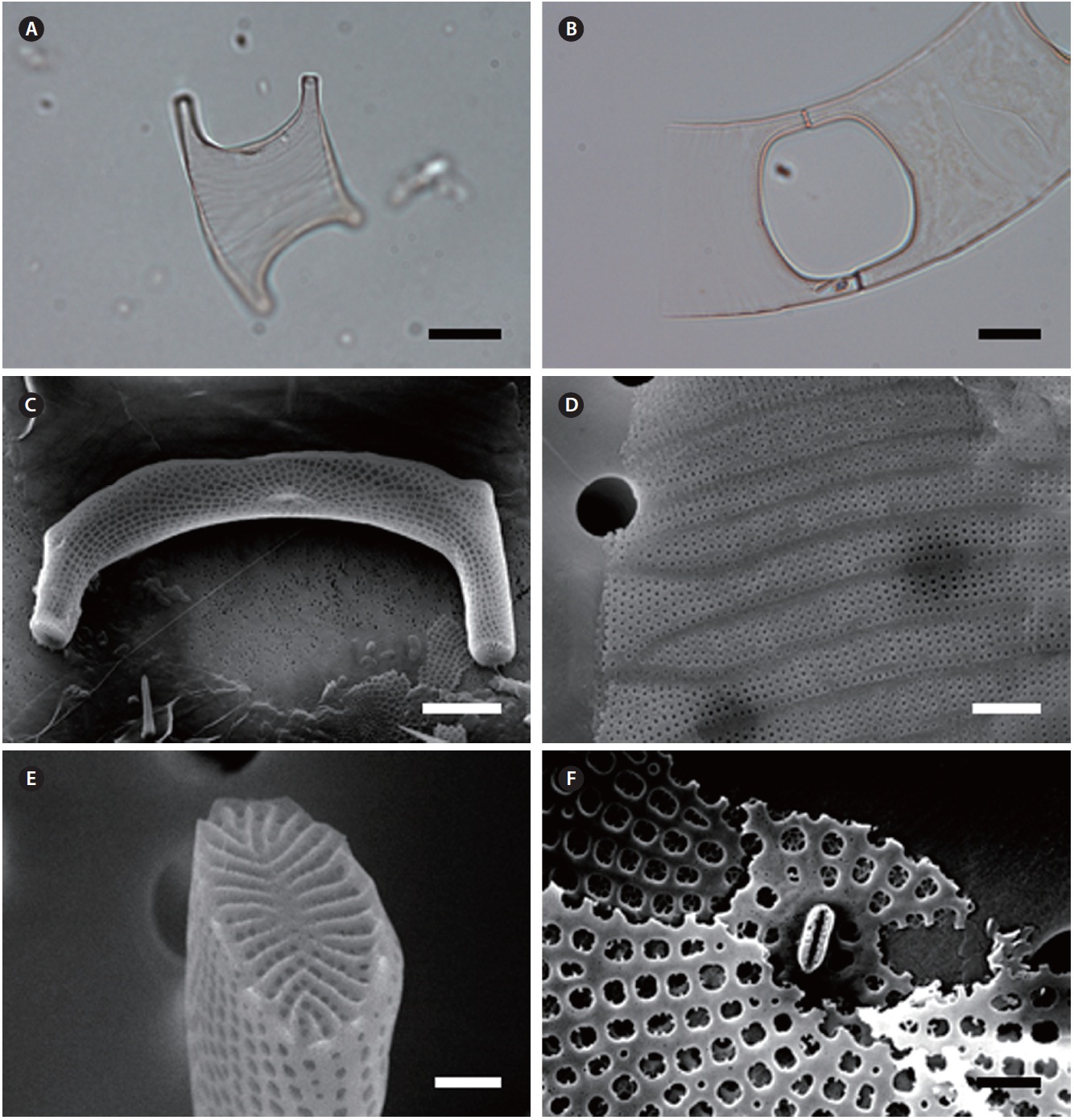 Eucampia zodiacus f. cylindrocornis. (A) Solitary cell with rectangular form in broad girdle view, light microscopy (LM). (B) Two-celled chain, almost rectangular aperture shape, LM. (C) Long and narrow cylindrical elevations, labiate process on the valve center, scanning electron microscopy (SEM). (D) Intercalary bands with rows of puncta, SEM. (E) Ocellus with linear ribs, SEM. (F) Labiate process, SEM. Scale bars represent: A & B, 10 μm; C, 5 μm; D, 2 μm; E & F, 1 μm.