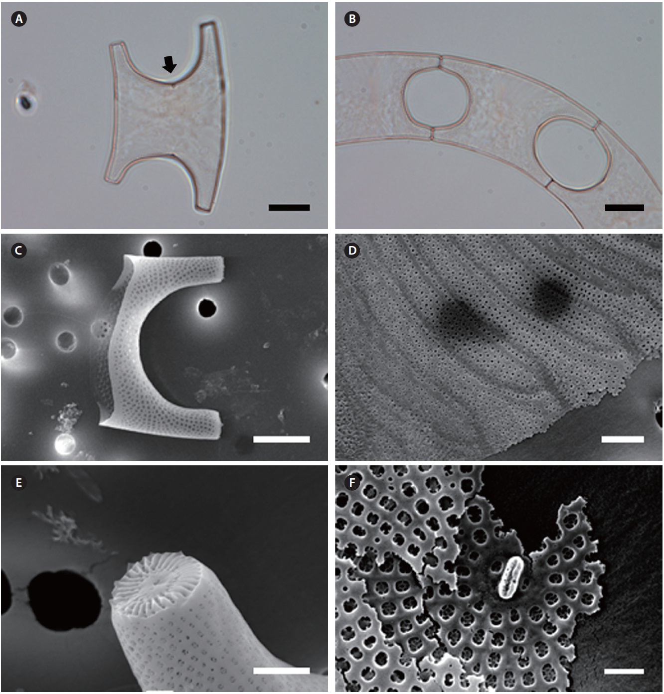 Eucampia zodiacus var. cornigera. (A) Solitary cell, labiate process on the valve center, light microscopy (LM). (B) Three-celled colony, rounded rhombic aperture shape, LM. (C) Long and broad conical elevations, scanning electron microscopy (SEM). (D) Intercalary bands with rows of puncta, SEM. (E) Ocellus with radial ribs, SEM. (F) Labiate process, SEM. Scale bars represent: A & B, 10 μm; C, 5 μm; D & E, 2 μm; F, 1 μm.