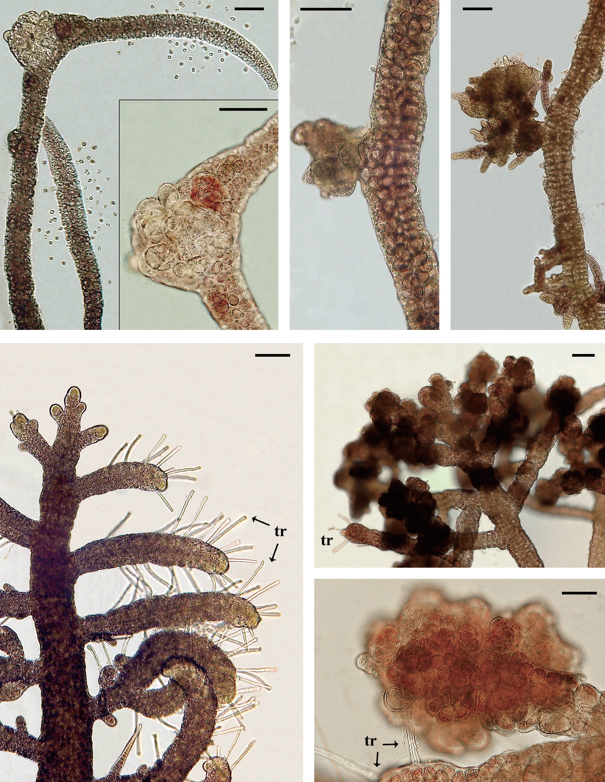Galls on Bostrychia radicosa, isolate 4178 (A & B); B. kelanensis, isolate 3810 (C & D); B. tenella isolate 2751 (E-G). (A) B. radicosa, elongate spermatangia bearing lateral branches with two galls visible on left. Released spermatia near branch tips also visible, small developing gall with normally pigmented cells visible on far left. (B) B. radicosa, high magnification, enlarged cells lightly pigmented with enlarged vacuoles. (C) B. kelanensis, developing gall with normally pigmented cells projecting from branch. (D) B. kelanensis, older galls with extensive branch formation. (E) B. tenella, normal procarpic branches with abundant trichogynes (tr). (F) B. tenella, numerous galls on procarpic branches, trichogynes (tr). (G) B. tenella, high magnification of gall cells, tier and cortical cells with fully pigmented chloroplasts, trichogynes (tr). Scale bars represent: A & B, 50 μm; C & D, 77 μm; E & F, 100 μm; G, 25 μm.