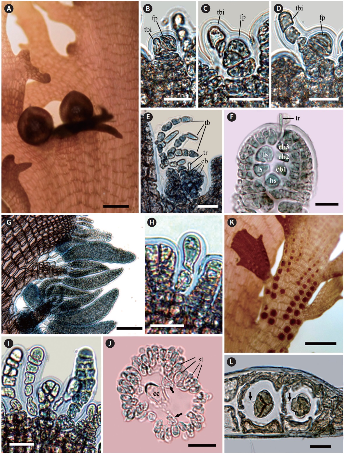 Reproductive structure of Symphyocladia glabra sp. nov. (A) Female reproductive organ producing on the upper margin of blade. (B-F) Development of female reproductive organ (bs, basal sterile cell; cb, carpogonial branch; fp, fertile pericentral cell; ls, lateral sterile cell; tb, trichoblast; tbi, trichoblast initial; tr, tricogyne). (G) Spermatangial branchlets producing along the upper margin of blade. (H & I) Development of male reproductive organ. (J) Cross-section view of mature spermatangial branchlet showing a central cell (cc) and pericentral cells (arrows) surrounded by numerous spermatangia (st). (K) Tetrasporangial stichidia producing on the upper margin of blade. (L) Development of tetrasporangia, which are connected with a stalk cell by a pit-connection (arrows). Scale bars represent: A, 500 μm; B-D, H-J & L, 20 μm; E & F, 50 μm; G, 100 μm; K, 300 μm.
