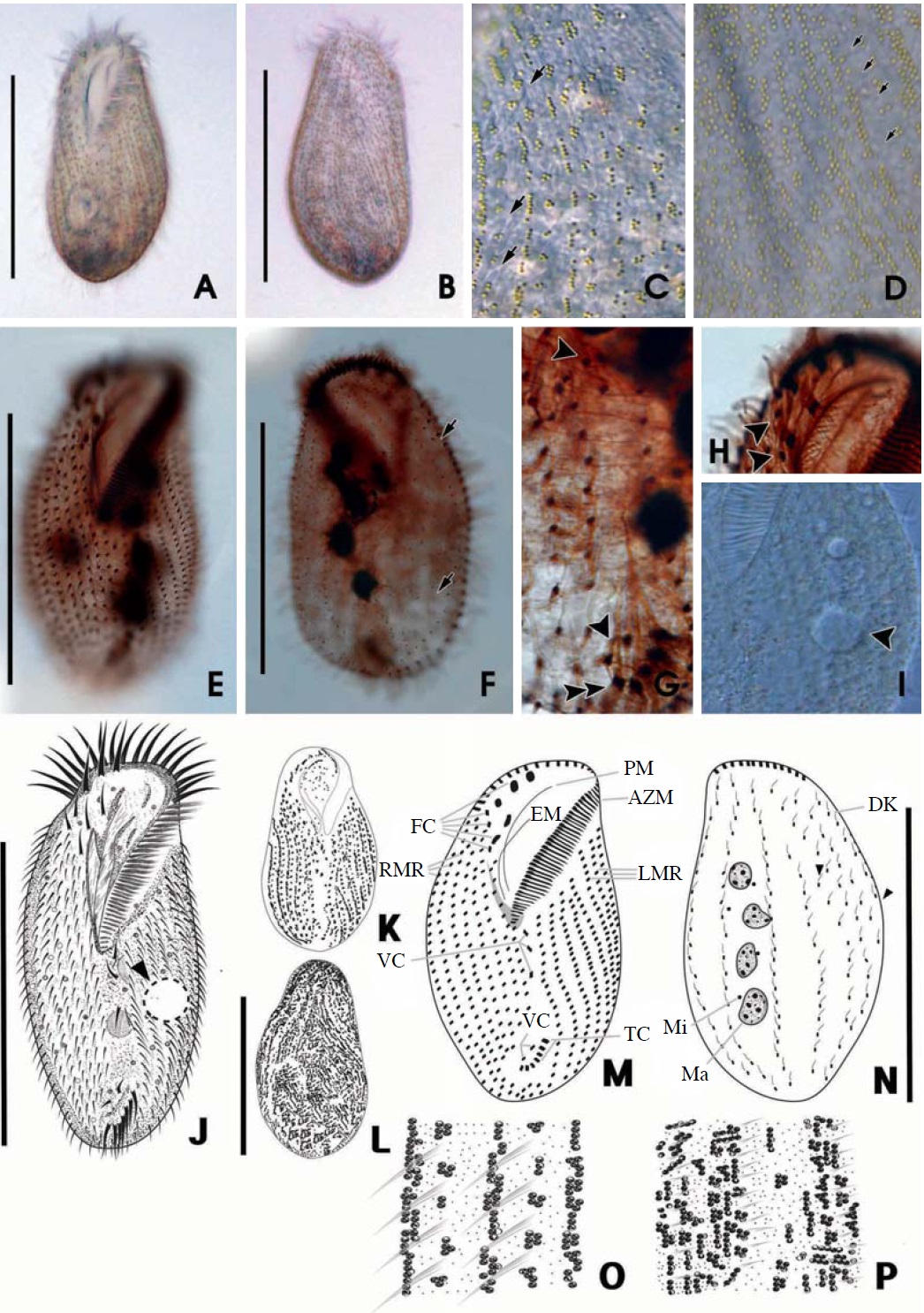 Morphology of Ponturostyla enigmatica from live (A-D, I-L, O, P) and protargol impregnated (E-H, M, N) specimens. A, C, I, Ventral views of live specimens: C, Greenish cortical granules arranged in lines between cirri (arrows); I, Arrowhead marking the contractile vacuole. B, Dorsal view of live specimen; D, Irregular distribution of greenish cortical granules on the dorsal side; E, F, Infraciliature of the ventral (E) and dorsal (F) side: F, Arrow marking shortened dorsal kineties; G, 5 (3+2) ventral cirri (arrowheads) and 5 transverse cirri (double arrowhead); H, 8 frontal cirri (arrowhead). J-P, Drawing view of P. enigmatica: J-L, The ventral (J, K) and dorsal (L) view of live specimen; J, Arrowhead indicating the contractile vacuole; M, N, Infraciliature of the ventral (M) and dorsal (N) side; O, P, Arrangement of cirri and cortical granules of the ventral (O) and dorsal (P) side. AZM, adoral zone of membranelles; DK, dorsal kineties; EM, endoral membrane; FC, frontal cirri; LMR, left marginal row; Ma, macronuclei; Mi, micronuclei; PM, paroral membrane; RMR, right marginal row; TC, transverse cirri; VC, ventral cirri. Scale bars: A, B, E, F, J, L, N=100 μm.