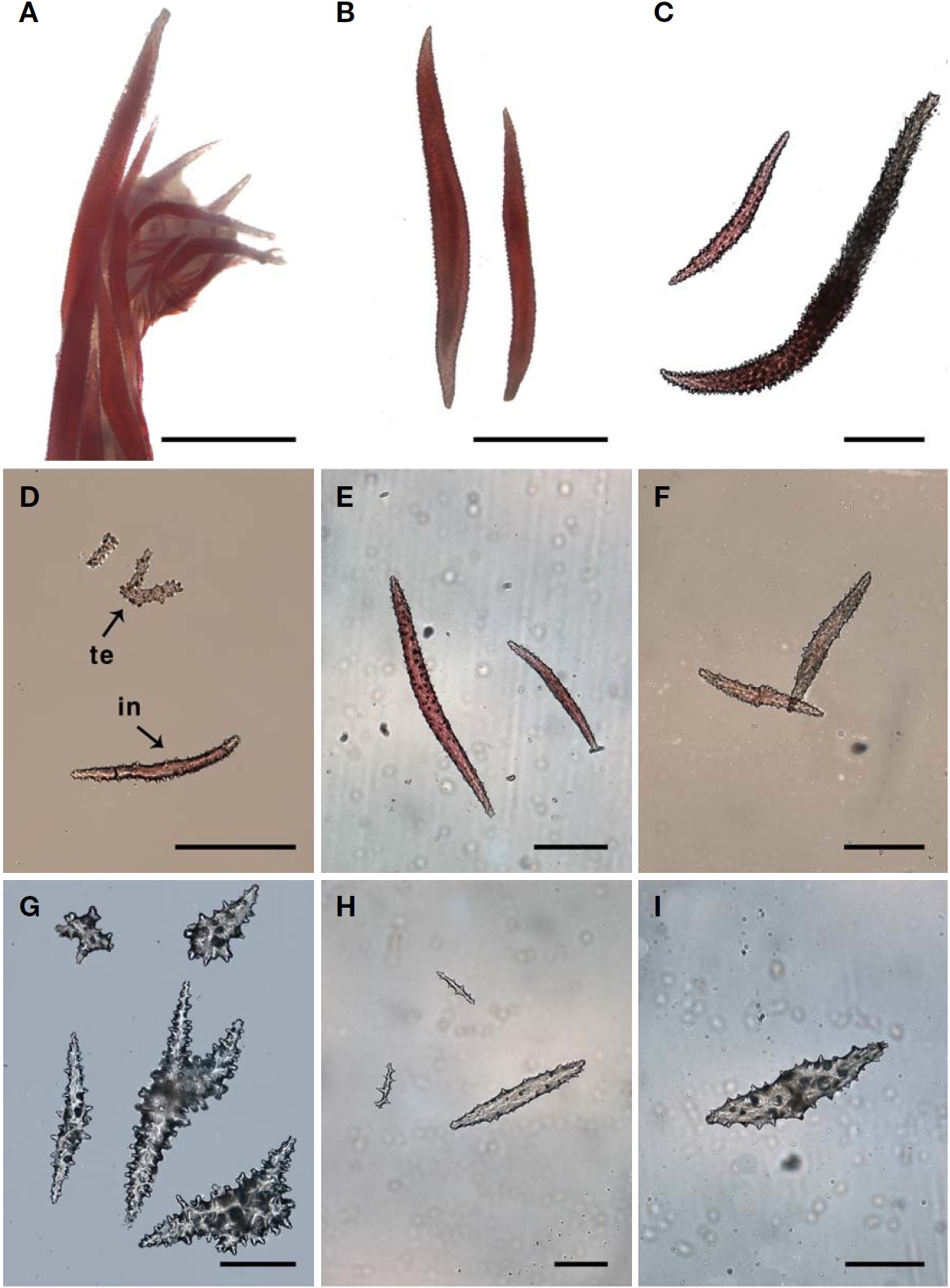 Sclerites of Dendronephthya (Dendronephthya) koellikeri. A, Polyp armature; B, Supporting bundle; C, Point; D, Tentacle (te) and intermediate (in); E, Polyp stalk; F, Branch cortex; G, Stalk cortex; H, Canal wall of branch; I, Canal wall of stalk. Scale bars: A, B=1 mm, C-I=0.2 mm.