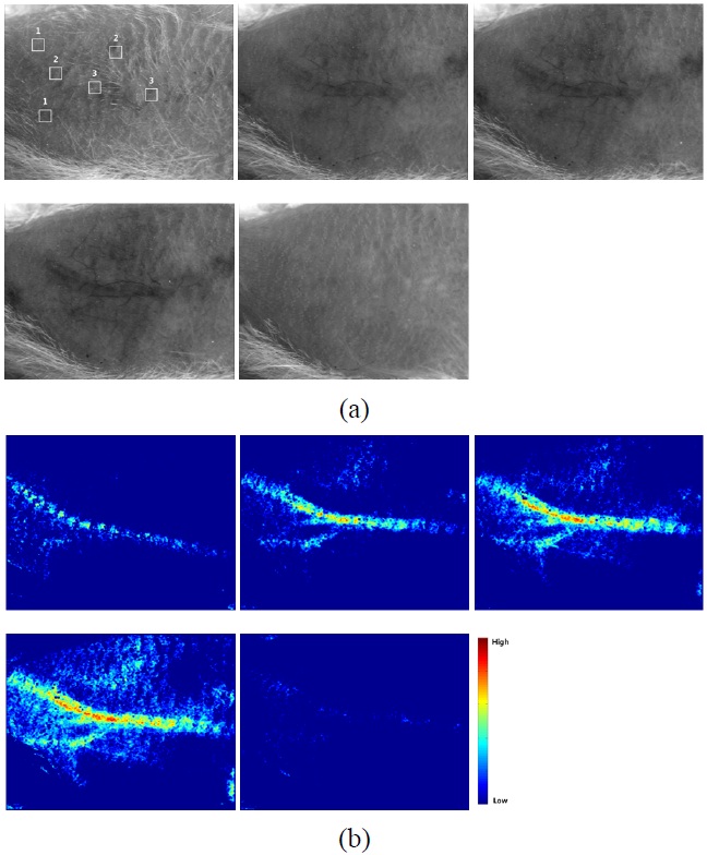 (a) The images from left to right indicate white light images of in vivo ICR mouse obtained at 0, 10, 20, and 30 min after the application of the physicochemical tissue optical clearing (PCTOC), and 30 min after the application of the saline solution at the end of PCTOC application. Regions 1, 2, and 3 indicate nonvasculature, small, and large vasculature regions. (b) Laser speckle contrast images (LSCI) of (a).
