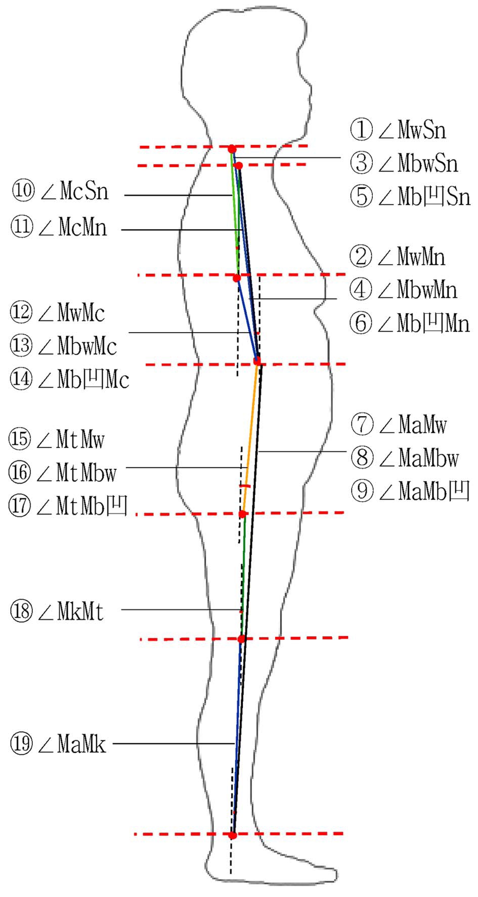Measurement item of axis angle in profile body.