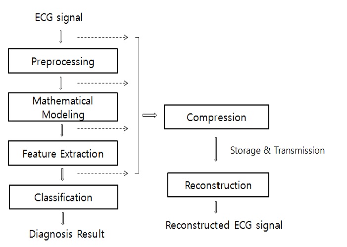 Overall block diagram of the electrocardiogram signal model.