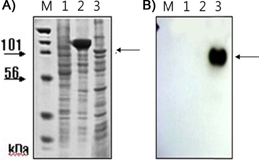 SDS-PAGE of cell lysates (A) and Western blots of cell culture media (B) for chimeric nuecin and enbocin fused with bPDI-KDEL. Sf9 cells (3.0×106) were infected with recombinant baculovirus [vAc-(bPDI-KDEL)-mNuecin-mEnbocin; lane 3)] encoding (bPDI-KDEL)-mNuecin-mEnbocin-His6. Cells and cell culture media were harvested 96 h after infection (A). Western blots were performed using His6-tag antibody (B). Lane 1, proteins extracted from normal cells; lane 2, proteins extracted from cells infected with wild-type baculovirus. Arrows indicate the putative (bPDI-KDEL)-mNuecin-mEnbocin band.