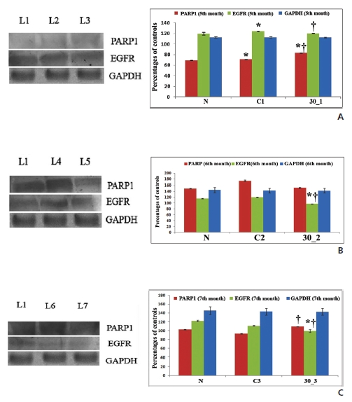 Western blot analyses of PARP1 and EGFR. (A) L1-normal, L2-cancer, and L3-Condurango-30C-treated (after 5th month). (B) L4-cancer and L5-Condurango-30C-treated (after 6th month). (C) L6-cancer and L7-Condurango-30C-treated (after 7th month). The relative band intensities shown in the histograms are averages ± SDs; n = 6. Signi？cance *P < 0.05 normal vs. cancer (5th (A), 6th (B) & 7th (C) month intervals) and normal vs. Condurango-30C treatment (5th, 6th & 7th month intervals); † P < 0.05 cancer (5th, 6th & 7th month intervals) vs. Condurango-30C treatment (5th, 6th & 7th month intervals).