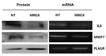 Validation of microarray analysis results by using Western blot and RT-PCR analyses. Expressions of IL8 and MMP were examined by using a Western blot analysis with an anti-IL8 and MMP7 antibody (left panel) and by using a RT-PCR analysis (right panel). Expression of PLAUR was examined as described above. Beta-actin protein was used as a loading control for Western blot, and GAPDH was used as a normalization control forsemi-quantitative PCR.