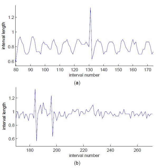 (a) The peak caused by missed beat. (b) The two peaks are result of incorrectly detecting ectopic beats as R-beats.