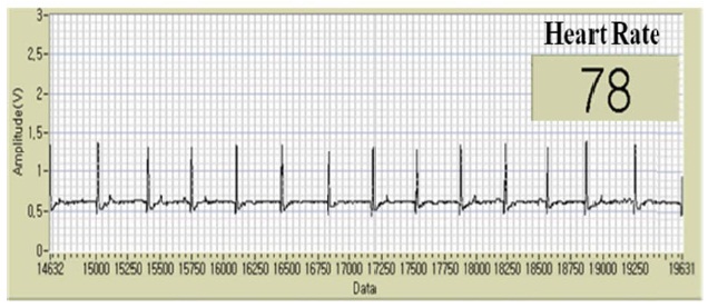Electrocardiogram data sent from the sensor node and heart rate calculated with LabVIEW.