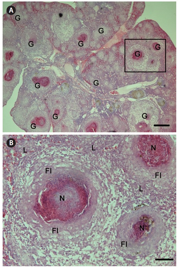 Histopathology of mycobacteriosis in Macropodus opercularis. (A) Numerous granulomas are present in spleen of diseased fish. G, granulomas. (B) Higher magnification of a square in (A) showing granuloma morphology. Fibrosis (FI) of the granulation tissue containing epithelioid cells. N, necrotic core; L, lymphocyte. Haematoxylin-eosin stain. Scale bars: A = 200 μm, B = 50 μm.