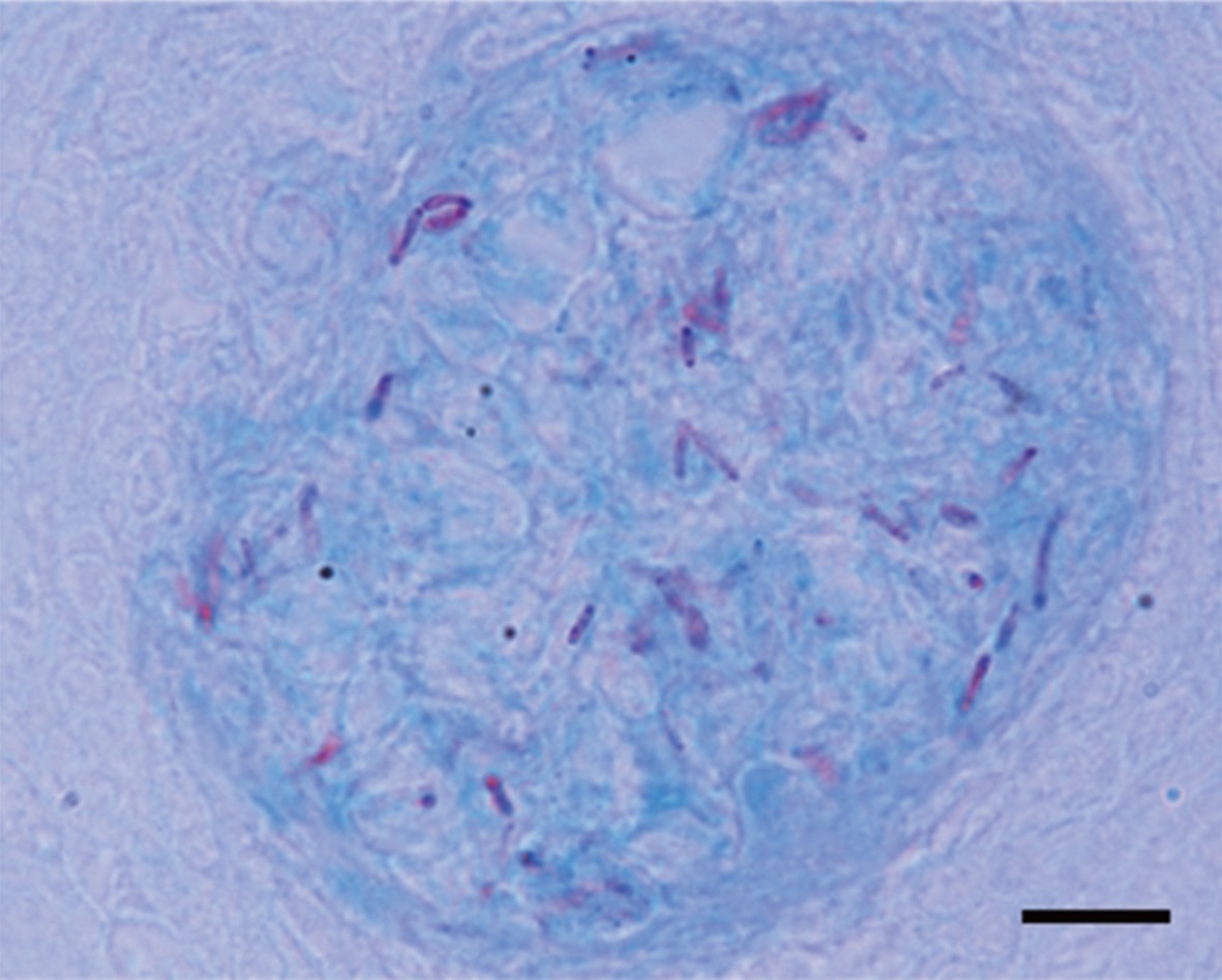 Mycobacteria infecting Macropodus opercularis. Ziehl-Neelsen stain of a section from spleen of diseased fish. Numerous acid-fast bacilli are present in the center of granuloma. Scale bar = 10 μm.