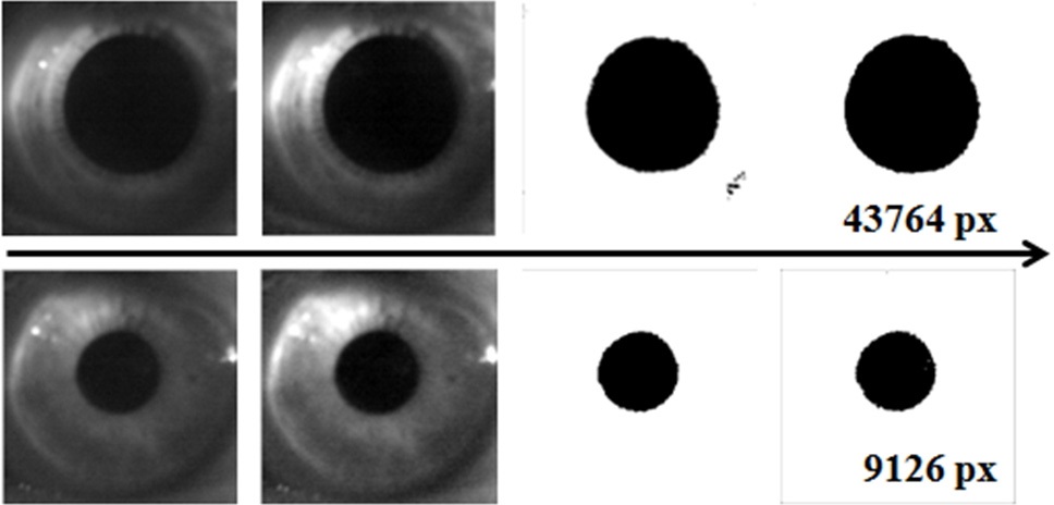 The progress of extracting the pupil region and the number of pixels corresponding to pupillary area is indicated at the end of the progress.