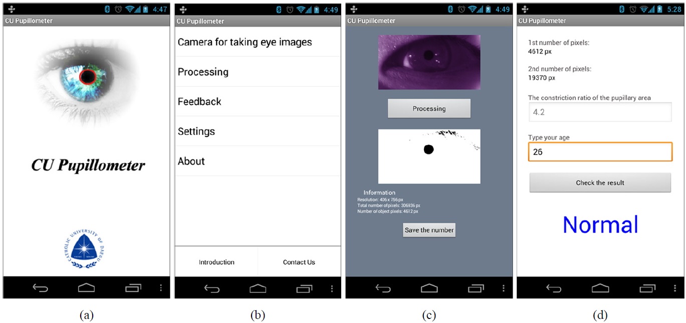 The interface of the menu based Android application. (a) The splash screen and (b) the menu in this application. (c) The eye image is processed through the proposed algorithm in the processing tab. (d) The results of the constriction ratio of the pupillary area are displayed in the feedback tab.