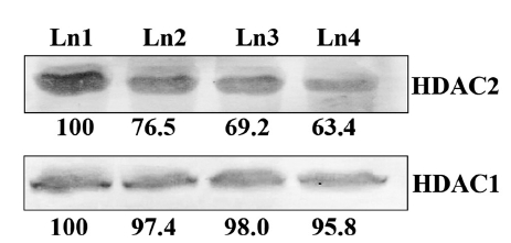 Immuno-blot assay: Ln1, Ln2, Ln3 and Ln4 denote a 4% placebo aliquot and 2%, 3% and 4% Condurango 30C aliquots, respectively.