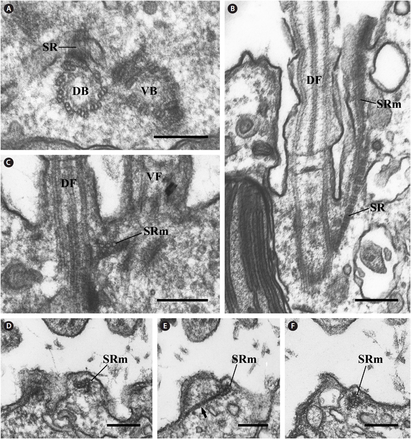 Transmission electron micrographs of the striated fibrous root (SR) and striated fiber-associated microtubular root (SRm). (A) Cross
section of the two basal bodies showing the SR originating at the ventral basal body. (B) Longitudinal section of the ventral flagellum (VF)
showing that that the SR and SRm extended parallel to the dorsal anterior lobe of the cell. (C) Longitudinal section of the two basal bodies
showing that the SRm originated between the two basal bodies and consisted of three microtubules. (D-F) Serial cross sections of the SRm
showing that the number of microtubules gradually increased to five and that the SRm consisted of four microtubules associated with a wing-like
structure. DB, dorsal basal body; DF, dorsal flagellum; VB, ventral basal body. Scale bars represent: A-F, 0.2 μm.