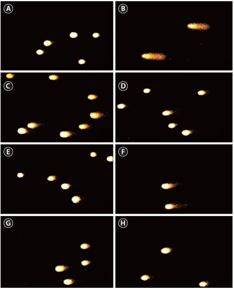 Comet images of L5178 cells. (A) Negative control. (B) 50 μM H2O2.. (C) 25 μg mL-1 methanolic extract with ultrasonic extraction (UE) 12 h (100MEU-12h) + 50 μM H2O2. (D) 50 μg mL-1 100MEU-12h + 50 μM H2O2. (E) 100 μg mL-1 100MEU-12h + 50 μM H2O2. (F) 25 μg mL-1 methanolic extract with conventional extraction (CE) 24 h (100MEC-24h) + 50 μM H2O2. (G) 50 μg mL-1 100MEC-24h + 50 μM H2O2. (H) 100 μg mL-1 100MEC-24h + 50 μM H2O2.