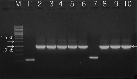 Proof of the presence of the Lfb-N gene in pCAMLfb-N by colony polymerase chain reaction. The Lfb-N gene was confirmed in all selected colonies except T1 and T7. M, 1-kb DNA ladder; lanes 1-10, randomly selected colonies (T1-T10).