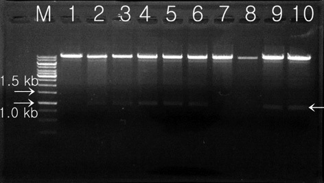 Proof of the presence of the Lfb-N gene in pCAMLfb-N by digestion reaction. The Lfb-N gene was confirmed in all selected colonies except T1, T7, and T8. M, 1-kb DNA ladder; lanes 1-10, randomly selected colonies (T1-T10).