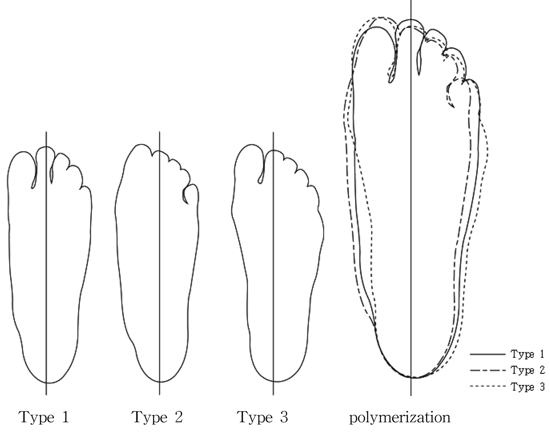 The representative silhouette by the sole types.