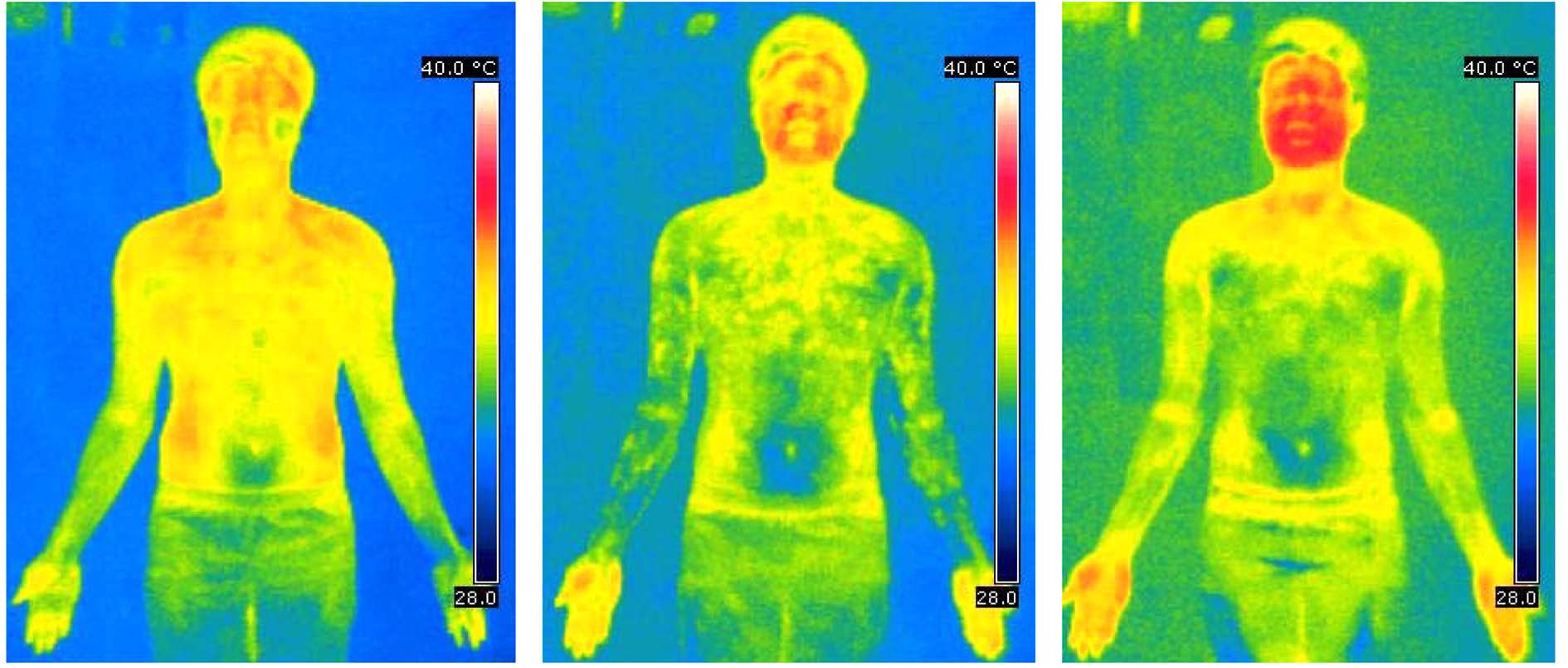 Thermography of protocol on ①, ②, ③ stages steps points.