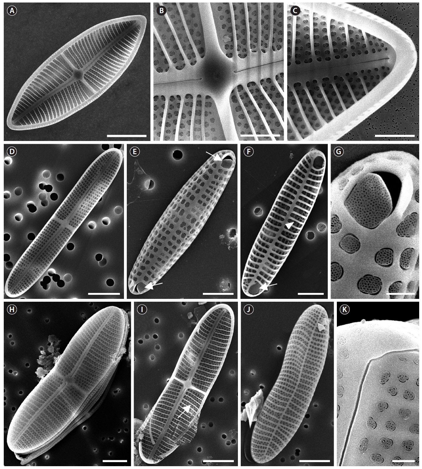 SEM microphotographs of the Achnanthes spp. (A) Internal view of RV of the A. javanica. (B) Central area (stauros) of RV of the A. javanica. (C)
Terminal end and costae of RV of the A. javanica. (D) Internal RV of the A. kuwaitensis. (E) ARV with terminal obiculi (arrows) of the A. kuwaitensis. (F) Internal
ARV with terminal obiculi (arrows) and costae (arrowhead) of the A. kuwaitensis. (G) Terminal obiculi of the A. kuwaitensis. (H) RV of the A. longipes. (I)
Internal RV with costae (arrow) of the A. longipes. (J) External RV of the A. longipes. (K) Raphe ending of the A. longipes. Scale bars represent: A, 20 μm; B, C, E,
F, 5 μm; D, H-J, 10 μm; G, K, 1 μm.