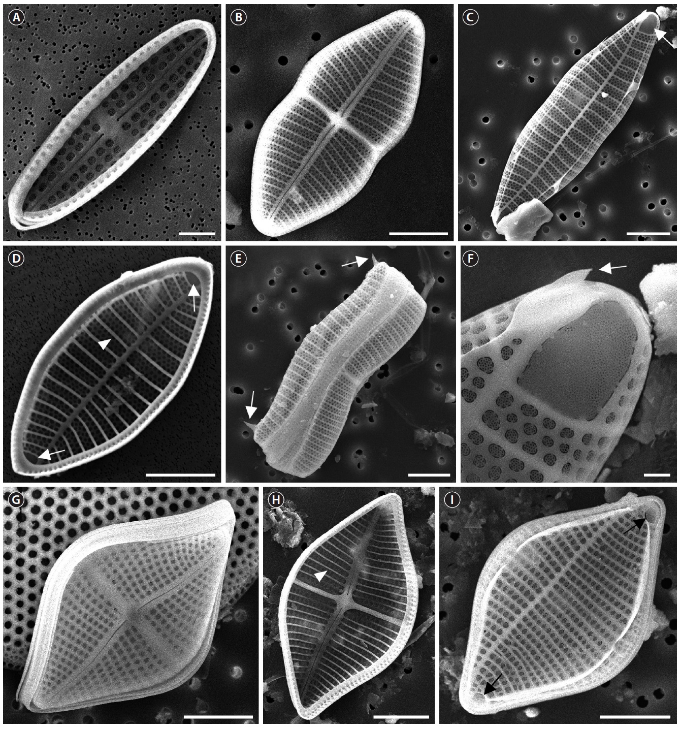 SEM microphotographs of the Achnanthes spp. (A) Internal RV of the A. parvula. (B) RV of the A. subconstricta. (C) ARV with terminal obiculi (arrow)
of the A. subconstricta. (D) Internal ARV with terminal obiculi (arrows) and costae (arrowhead) of the A. subconstricta. (E) Girdle view with terminal spines
(arrows) of the ARV of the A. subconstricta. (F) Terminal obiculi and spine (arrow) of the A. subconstricta. (G) RV of the A. yaquinensis. (H) Internal RV with
costae (arrow) of the A. yaquinensis. (I) ARV with terminal obiculi (arrows) of the A. yaquinensis. Scale bars represent: A, 2 μm; B-E & G-I, 10 μm; F, 1 μm.