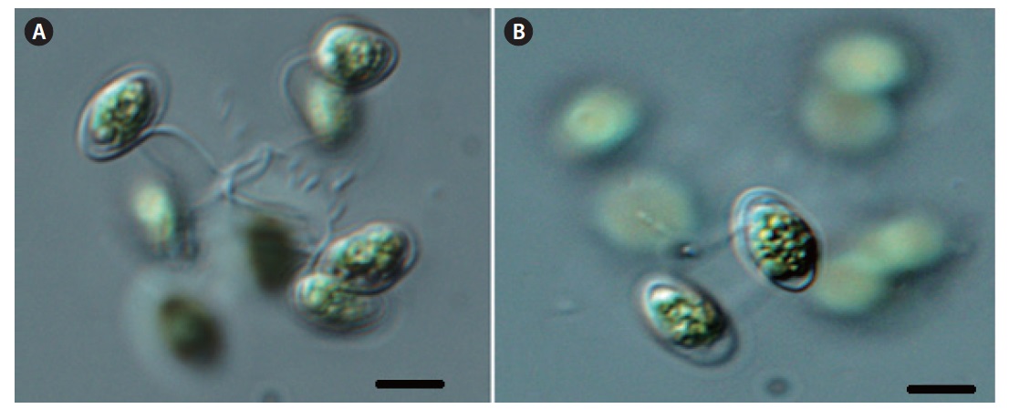 Dictyosphaerium elongatum Hindak (A-B: each other individual). Scale bars, 10 μm.