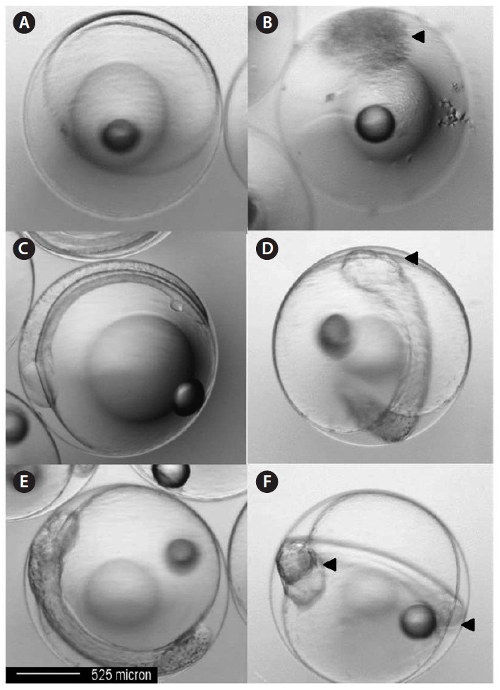 Paralithys olivaceus eggs exposed to 0 μg/L groups (A, C, E) and 40 μg/L Aroclor 1254 concentration groups (B, D, E). (A, C, E) Normal egg or embryo
of control group. (B) Darkening of outer layer of egg and irregular egg membrane (12 h after exposure). (D) No optic cup formation (24 h after exposure). (F)
Abnormal head region and undeveloped tail (36 h after exposure). The black arrows point out the abnormalities of egg or embryo exposed to Aroclor 1254.