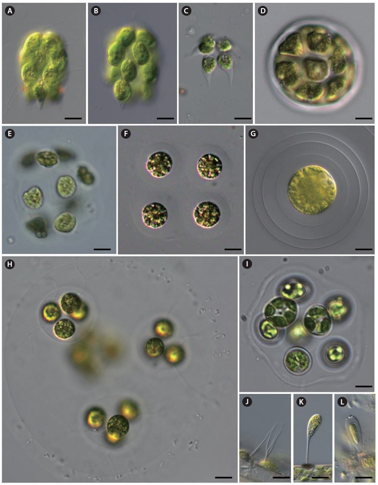 (A, B) Pyrobotrys crasinoensis, (C) P. squarrosa, (D, E) Volvulina steinii, (F, G) Asterococcus superbus, (H) Paulschulzia pseudovolvox, (I) Planktosphaeria gelatinosa, (J) Dicranochaete reniformis, (K) Characium guttula, (L) Pseudocharacium obtusum. Scale bars, 10 μm.
