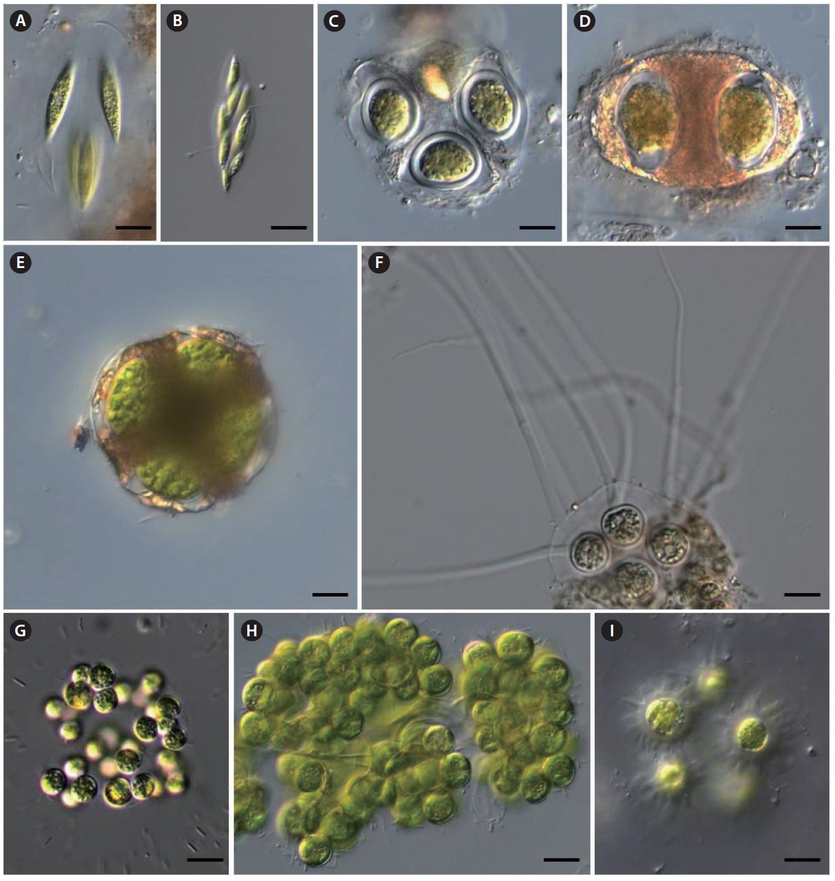 (A, B) Elakatothrix genevensis, (C-E) Gloeotaenium loitelsbergianum, (F) Gloeochaete wittrockiana, (G) Coenococcus planktonicus, (H) Botryosphaerella
sudetica, (I) Echinocoleum elegans. Scale bars, 10 μm.