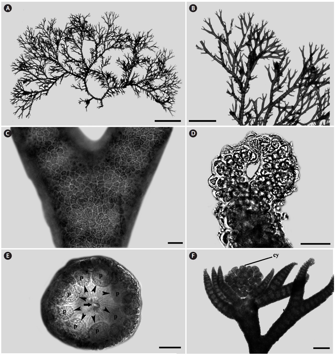 Ceramium pacificum from Jumunjin, Korea. (A) Female plant with numerous branchlets. (B) Details of branches. (C) Branching point with complete
cortication. (D) Apical region. (E) Axial cell (arrow) with 7-8 pericentral cells (arrowheads, p) in transverse section. (F) Mature cystocarp (cy). Scale bars
represent: A, 5 mm; B, 2 mm; C, 30 μm; D, E, 40 μm; F, 200 μm.