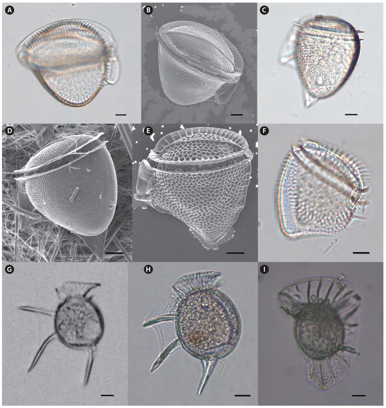 Light microscopy (LM) and scanning electron microscopy (SEM). (A) Dinophysis cuneus (LM), lateral view, (B) D. cuneus (SEM), (C) Dinophysis hastata
(LM), (D) D. hastata (SEM), (E) Dinophysis mitra (SEM), (F) D. mitra (LM), (G-H) Dinophysis schuettii (LM), (I) Ornithocercus heteroporus (LM). Scale bars, 10 μm.