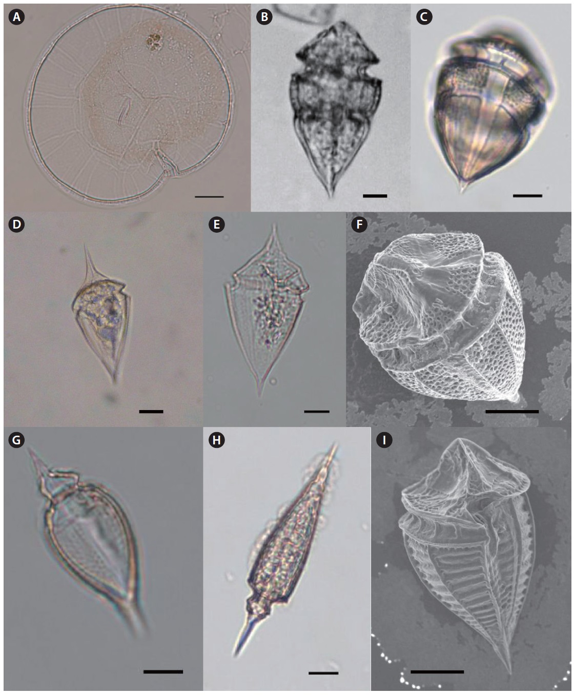 Light microscopy (LM) and scanning electron microscopy (SEM). (A) Pyrophacus steinii (LM), epitheca (B) Oxytoxum constrictum (SEM), lateral view,
(C) O. constrictum (LM), (D-E) Oxytoxum milneri (LM), lateral view, (F) Oxytoxum reticulatum (SEM), epitheca, (G) Oxytoxum sceptrum (LM), lateral view, (H)
Oxytoxum scolopax (LM), lateral view, (I) Oxytoxum tesselatum (SEM), ventral view. Scale bars, 10 μm
.