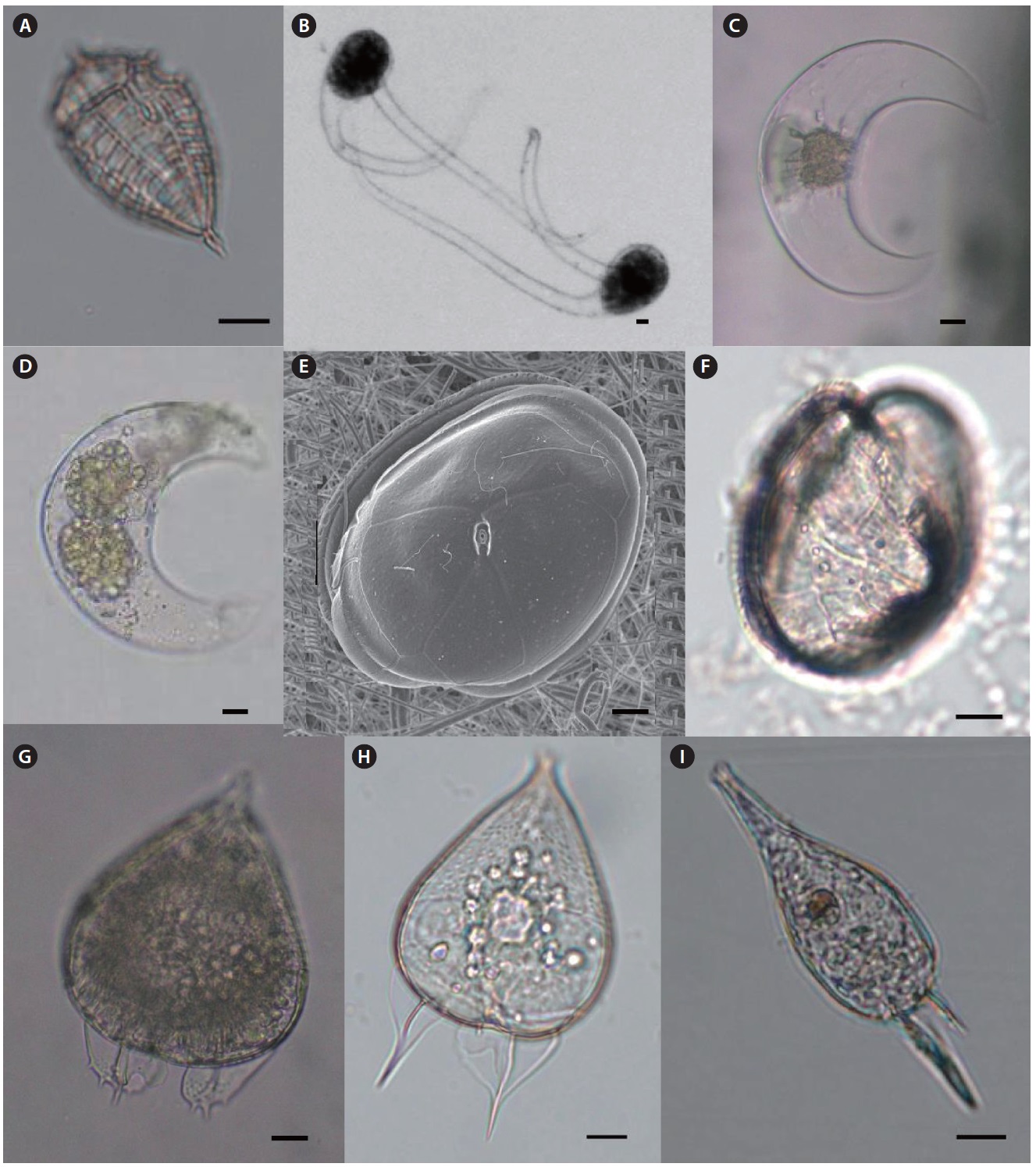 Light microscopy (LM) and scanning electron microscopy (SEM). (A) Oxytoxum tesselatum (LM), lateral view, (B) Pyrocystis hamulus (LM), (C-D)
Pyrocystis robusta (LM), (E) Dissodium asymmetricum (SEM), epitheca, (F) D. asymmetricum (LM), hypotheca, (G-H) Podolampas bipes (LM), (I) Podolampas
palmipes (LM). Scale bars, 10 μm.