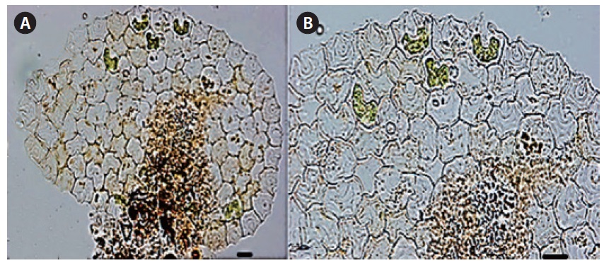 Pediastrum angulosum var. asperum Sulek in Komarek et Fott (A: ×320, B: ×640). Scale bars, 10 μm.
