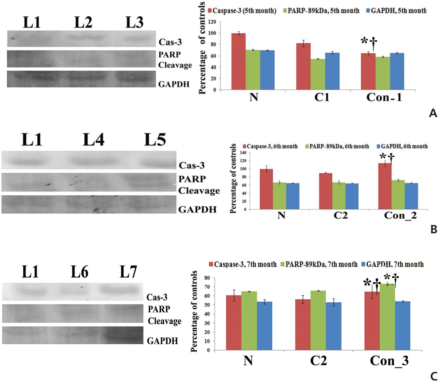 Study on expression of caspase-3 and PARP by western blot at different post-cancerous time points. *P < 0.05 normal vs. cancer and
normal vs. Condurango treatment at the 5th, 6th & 7th month, and †P < 0.05 cancer vs. Condurango treatment at the 5th, 6th & 7th month.
