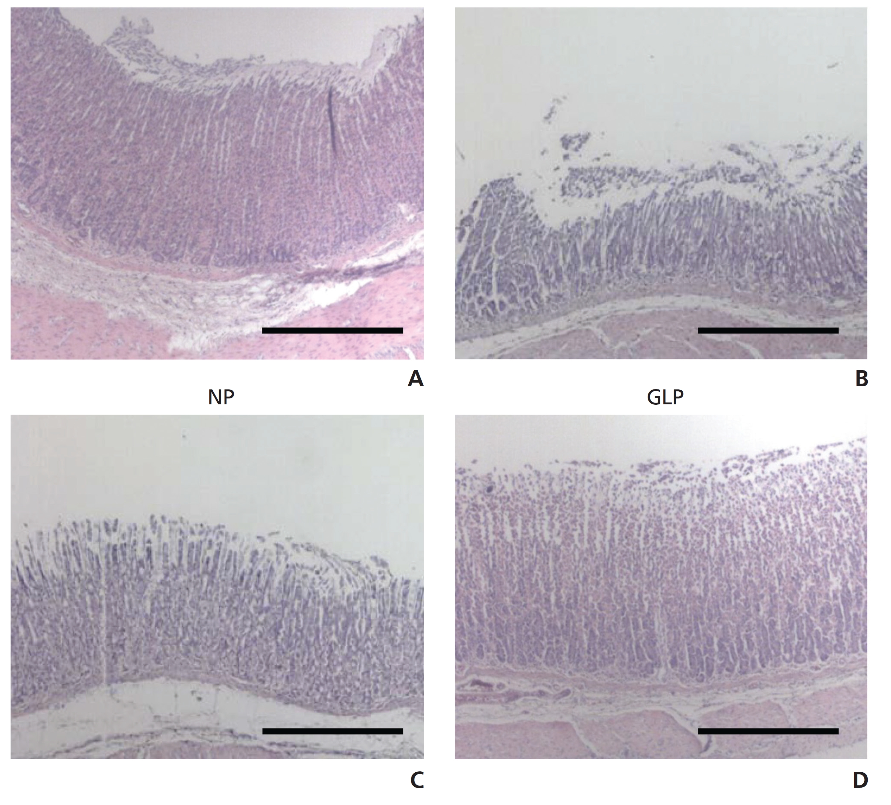 Light microscopic images of EtOH/HCl-induced acute ulcers in rats. Scale bar = 200 ㎛. Magnification: 40 ×; NP, injection of saline; GLP,
injection of Ganoderma lucidum pharmacopuncture.