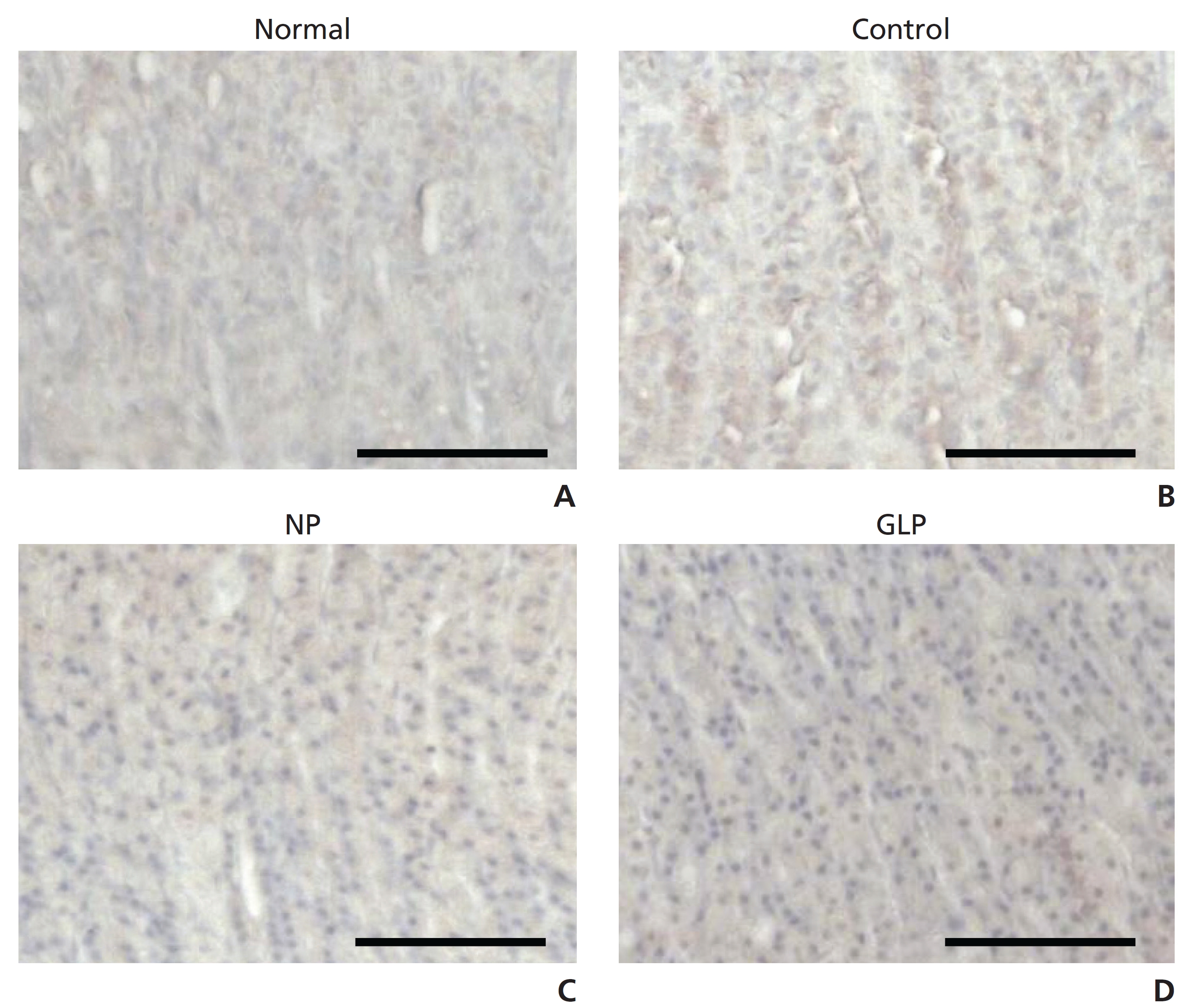 Immunohistochemical staining of TGF-β1 proteins in EtOH/HCl-induced acute gastric ulcers in rats. Scale bar = 100 ㎛. Magnification:
100 ×; NP, injection of saline; GLP, injection of Ganoderma lucidum pharmacopuncture.