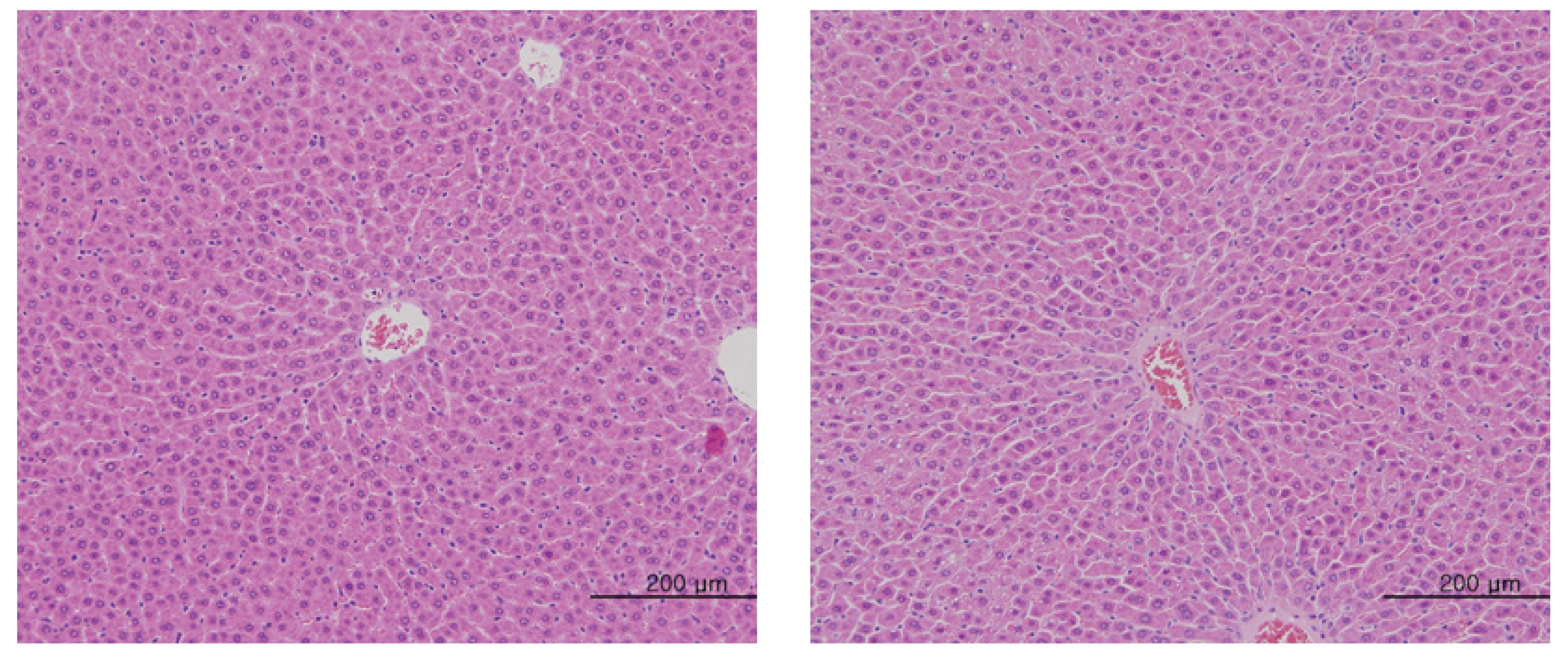 Liver tissue from an intravenous single-dose toxicity study of Mountain ginseng pharmacopuncturein Sprague-Dawley rats.
The high-dose group (20 mg/kg) and the control group show minimal changes of focal perivascular cell infiltration, extramedullary hematopoisis
and microgranuloma. Pathological change was detected by H&E staining. Lt, Control; Rt, Experimental group. × 200.