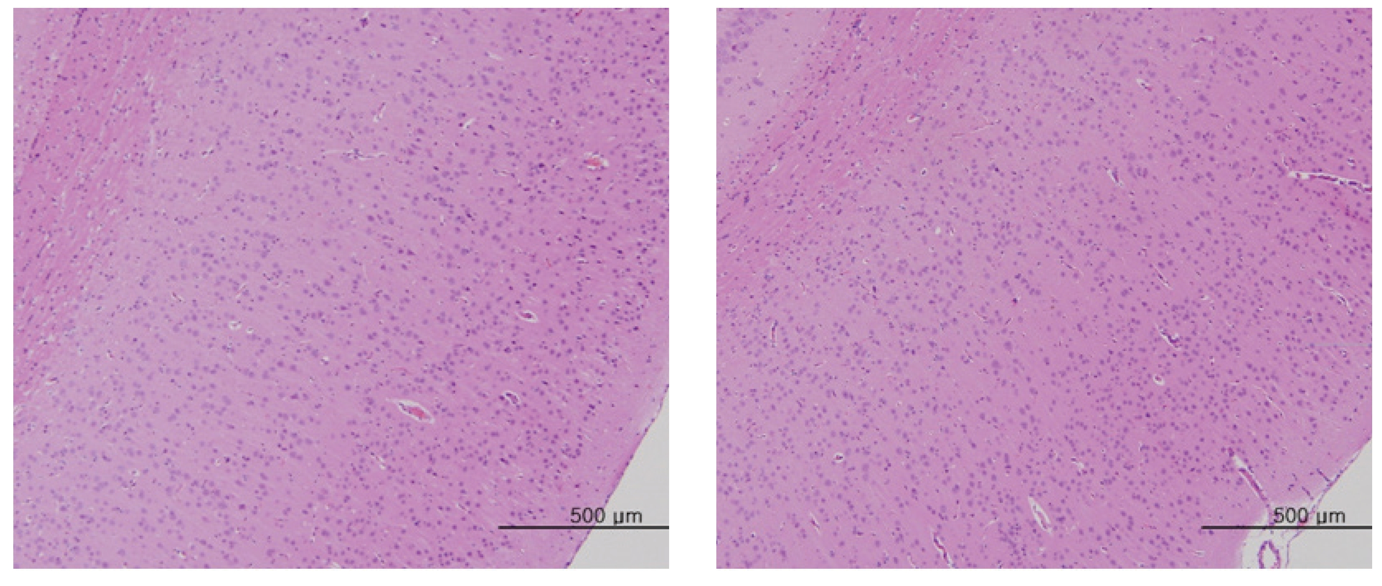 Brain tissue from an intravenous single-dose toxicity study of Mountain ginseng pharmacopuncture in Sprague-Dawley rats.
There are unremarkable changes in the brain, and the heart of the control and the 20 mL/kg groups. Pathological change was detected by H&E
staining. Lt, Control; Rt, Experimental group. × 200.