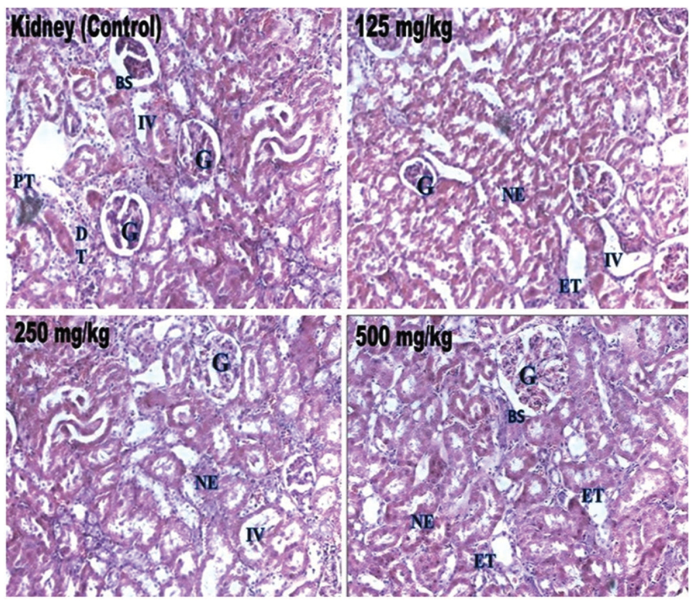 Histopathological examinations of rat kidney sections from
the control rats and from the test rats treated with extract of W. volubilis.
G, glomerulus; BS, Bowman space; PT, proximal tubule; DT, distal
tubule; IV, interstitial vessel; ET, epithelium of tubules; NE, normal
epithelium.