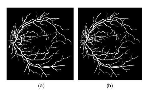 Results of segmentation: (a) Nguyen et al.’s method and (b) our method.