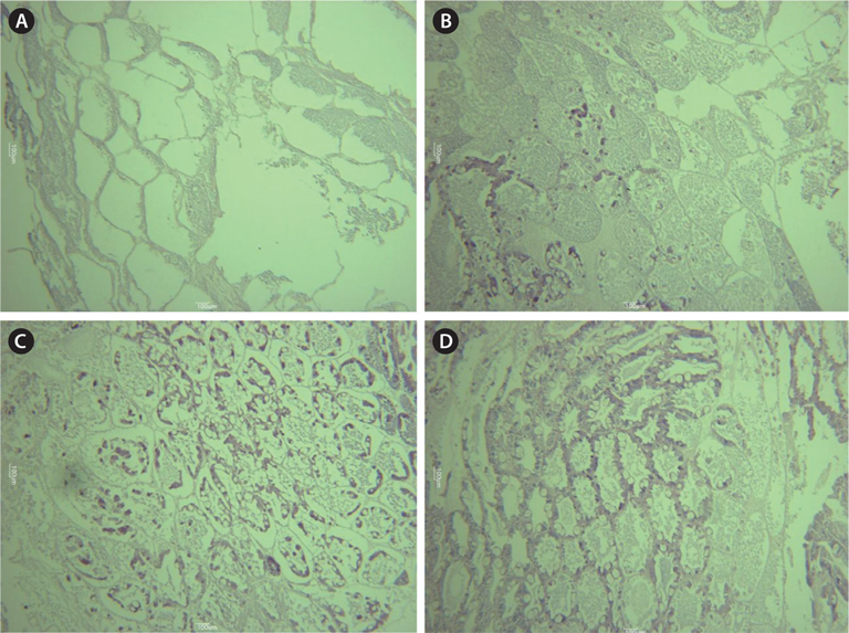 Histology of ovaries 31 days after methyl farnesoate (MF) and eyestalk ablation treatment. Each ovary was stained with H&E, and observed in light microscope(ⅹ100). (A) Control female; (B) 0.1 μg MF treated female; (C) 1.0 μg MF treated female; (D) unilaterally eyestalk ablated female.