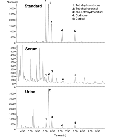 GC-MS total ion chromatograms of cortisol and cortisone and their metabolites (10 pg each in the standards) in two extracts, that is, human serum and urine samples. Data are from reference #4.