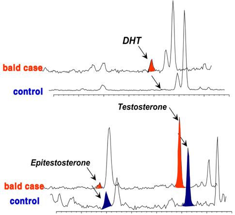 Reconstructed ion chromatogram (RIC) for the determination of DHT, epitestosterone, and testosterone in hair. Comparison of bald and control subject hair samples by selected-ion monitoring and chromatographed on an Ultra-1 (17 m × 0.2 mm i.d. × 0.11 mm film thickness) capillary column. The selected ion for DHT (tR = 12.78, a) was m/z 586, and the ions for epitestosterone (tR = 11.60, b) and testosterone (tR = 13.22, c) were m/z 584. Data are from reference #41.
