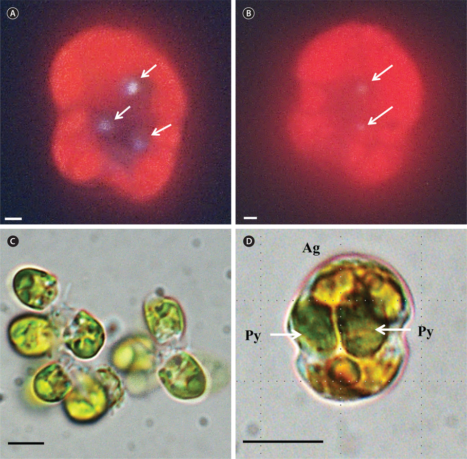 Feeding by the mixotrophic dinoflagellate Ansanella granifera feeding on bacteria and the prasinophyte Pyramimonas sp. (A) An A. granifera cell with 3 ingested fluorescent-labeled bacteria (arrows). (B) An A. granifera cell with 2 ingested cyanobacterium Synechococcus sp. (arrows). (C) Unfed Pyramimonas cells. (D) An A. granifera (Ag) cell with 2 ingested Pyramimonas (Py) cells (arrows). Scale bars represent: A & B, 1 ℃m; C & D, 5 μm.
