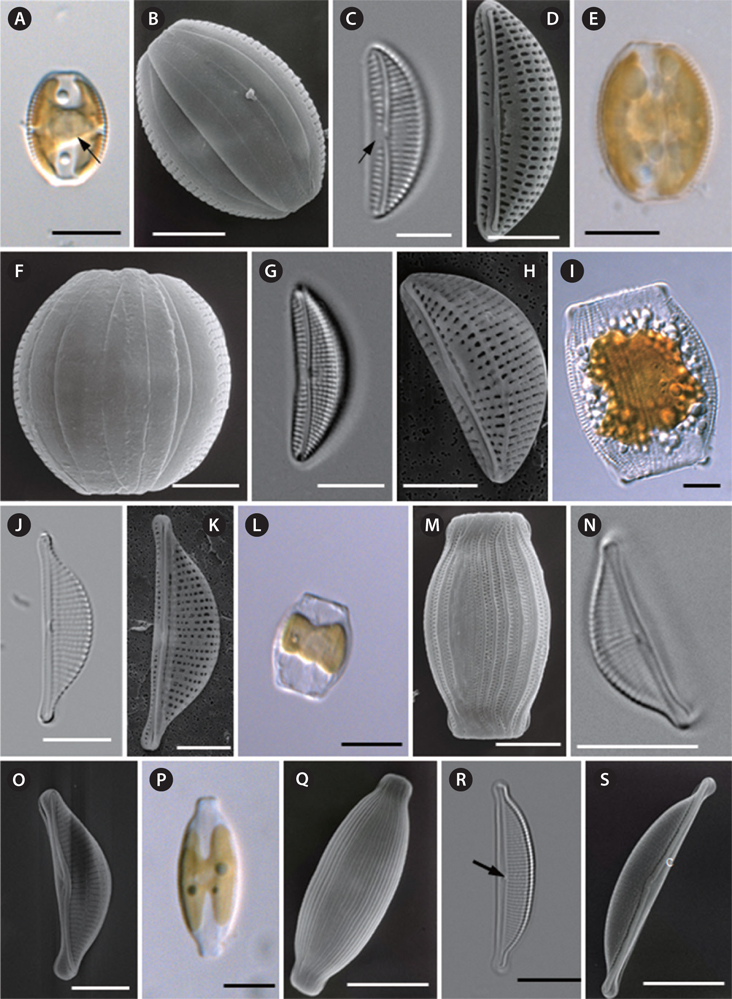 (A-D) Cells of Amphora marina with light microscopy (LM) and scanning electron microscopy (SEM) micrographs. (A) LM. Frustule in dorsal view. Note a rounded pyrenoid (arrow) at the central of cell and chloroplast adherent at the internal cell wall. (B) SEM. Frustule in dorsal view. Note girdle area of the frustule is not plicate. (C) LM. General appearance of the internal valve. Note central nodule conspicuously (arrow). (D) SEM. Another specimen photographed at a different tilt. Note the distribution of the ventral striae. (E-H) Cells of Amphora proteus with LM and SEM micrographs. (E) LM. Frustule in dorsal view. Note the truncate ends of the cell. (F) SEM. Frustule in dorsal view. Note girdle area of the frustule is not plicate. (G) LM. General appearance of the valve. Note the dorsal punctate. (H) SEM. Valve in external view, showing the narrow conopeum, the pattern of striation and marginal ridge. (I-K) Cells of Halamphora eunotia with LM and SEM micrographs. (I) LM. Frustule in dorsal view. Girdle area of the frustule is wide and plicate for the punctate girdle bands. (J) General appearance of the valve. Note the dorsal punctate striae, the raphe system and a conspicuous central nodule. (K) SEM. Frustule in ventral view. Note the raphe central terminals slightly bent to the dorsal side and then fold back. (L-O) Cells of Halamphora terroris with LM and SEM micrographs. (L) LM. Frustule in dorsal view. Note the broad girdle area. (M) SEM. Frustule in dorsal view. (N) LM. General appearance of the valve. Note the dorsal punctate striae, the raphe system and a conspicuous central nodule. (O) SEM. Frustule in ventral view. (P-S) Cells of Halamphora holsatica with LM and SEM micrographs. (P) LM. Frustule in dorsal view. Note the H-shape chloroplast. (Q) SEM. Frustule in dorsal view. Note the valve mantles and girdle bands. (R) LM. General appearance of the valve. Note the dorsal punctate striae, the raphe system and a conspicuous central nodule (arrow). (S) Valve in external view showing the narrow conopeum (c). Scale bars represent: A, E, G, J, L, N & P-S, 10 μm; B-D, F, H, I, K, M & O, 5 μm.
