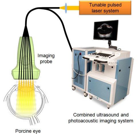 Array-based combined ultrasound and photoacoustic imaging system.