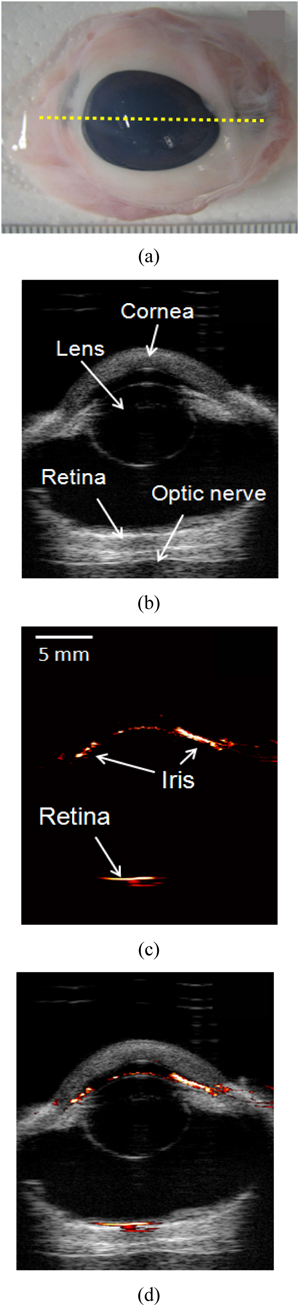 (a) A top-view picture of an ex vivo porcine eye. (b) Ultrasound, (c) photoacoustic, and (d) combined images of the porcine eye along the yellow dotted line in (a).